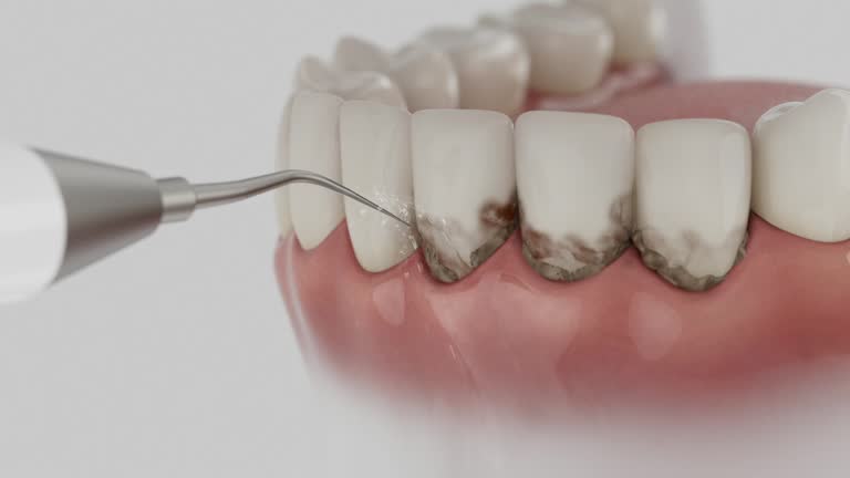 Trusted Teeth Cleaning And Checkup service in Renova, MS - Dentist Open Now